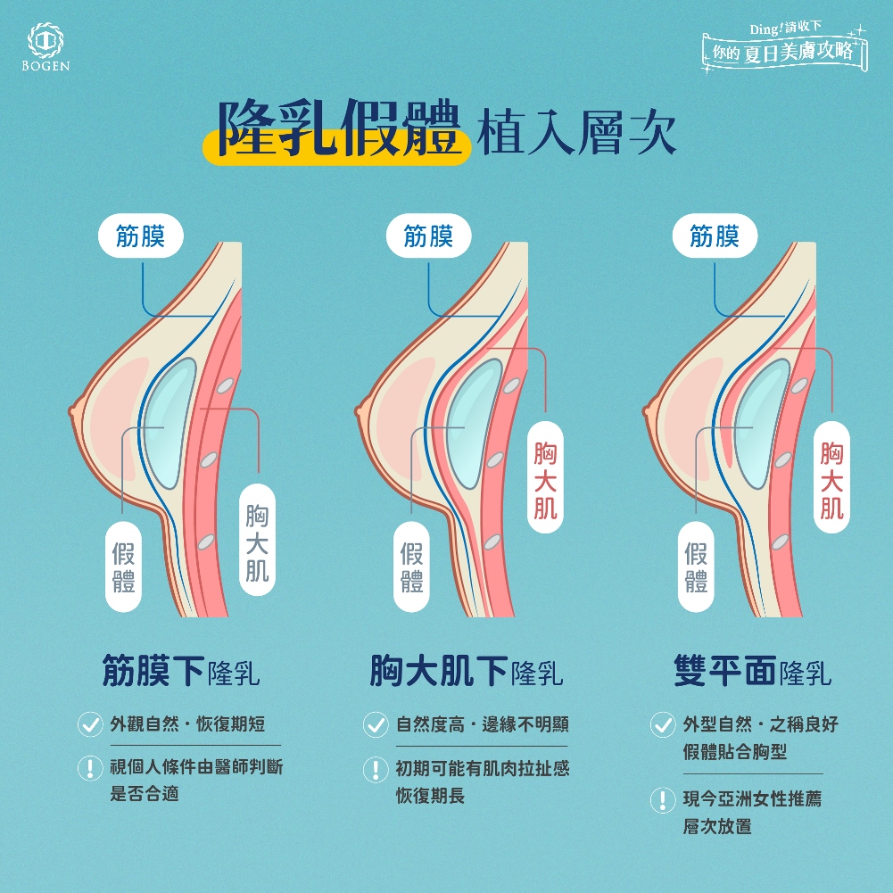 隆乳假體植入位置,隆乳手術,博恩妍